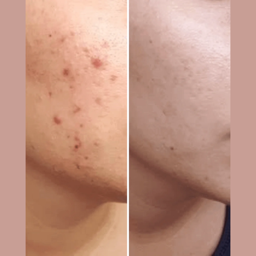 Arencia Fresh Red Glow Booster Serum - Even, Bright & Glass Skin