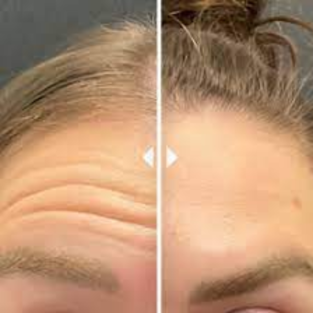 Seoul 1988 Retinal Cream - Remove Fine lines + Wrinkle & Give Clean, Tight & Glowy Skin