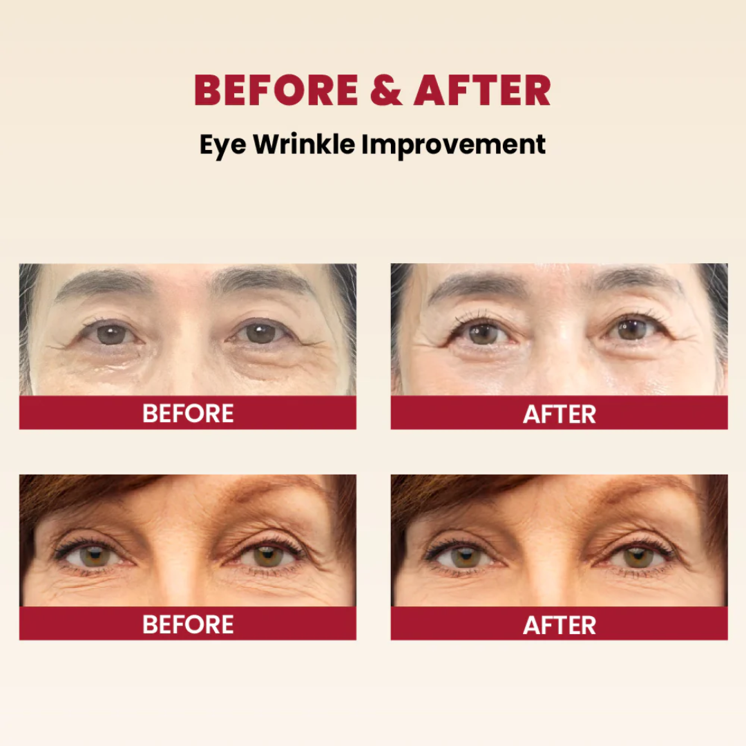 Seoul 1988 Retinal Cream - Remove Fine lines + Wrinkle & Give Clean, Tight & Glowy Skin